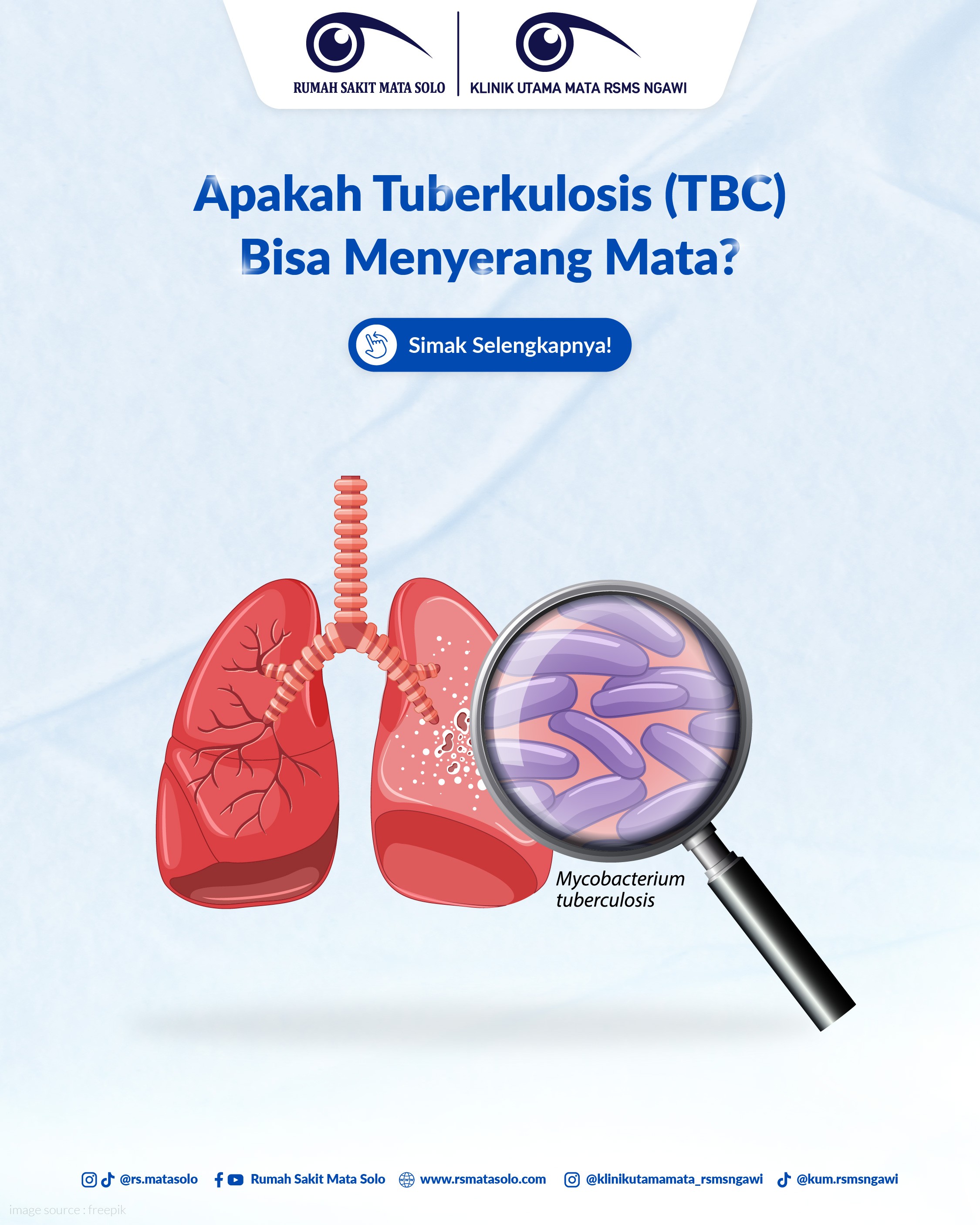 Apakah Tuberkulosis (TBC) Bisa Menyerang Mata?
