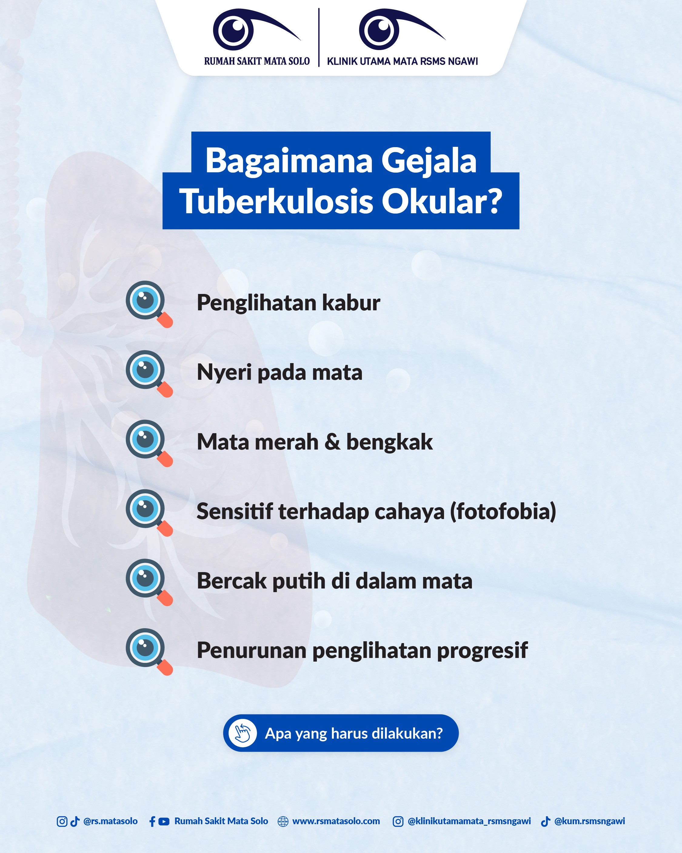 Gejala Tuberkulosis TBC Mata RS Mata Solo