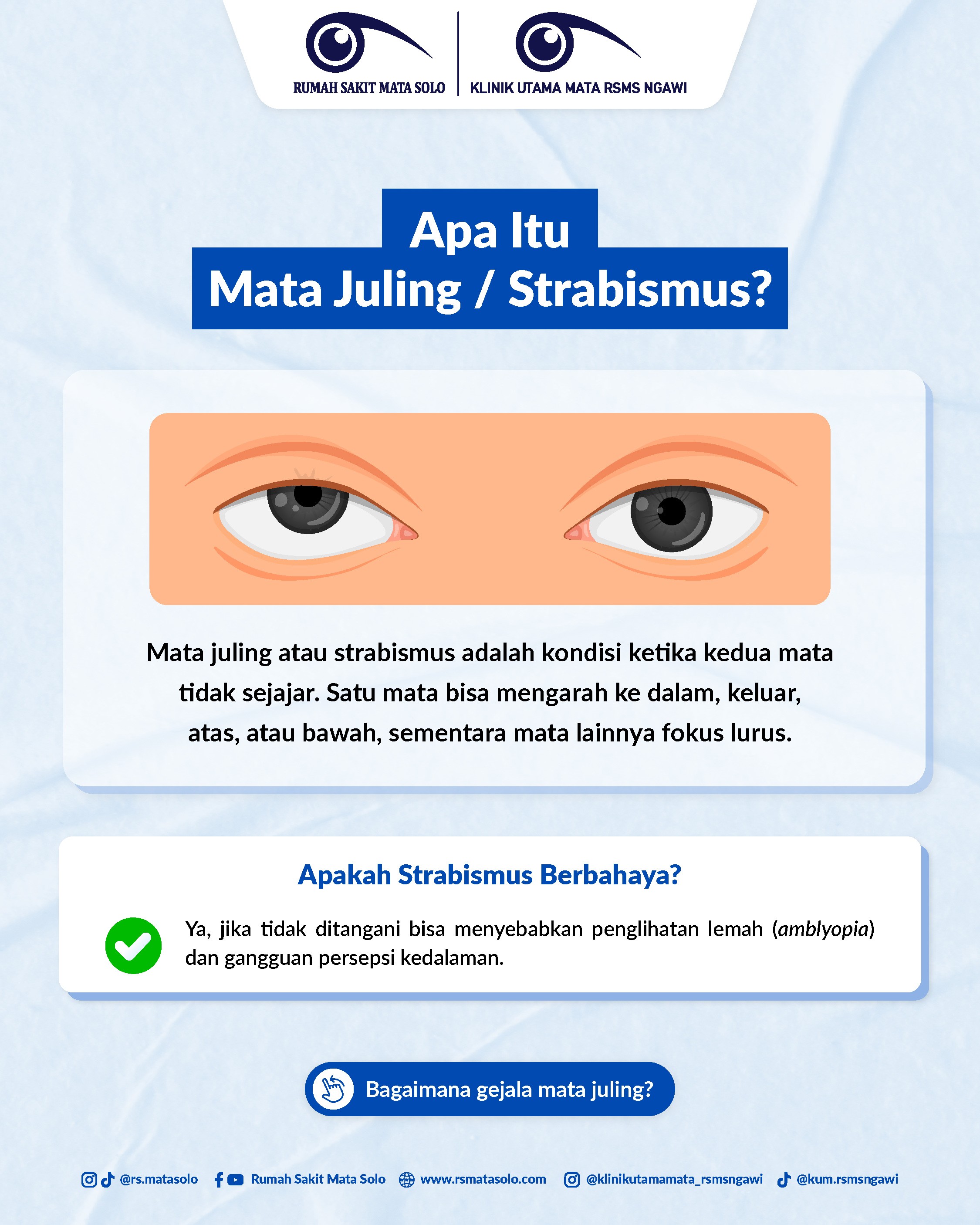 Mata Juling Strabismus RS Mata Solo