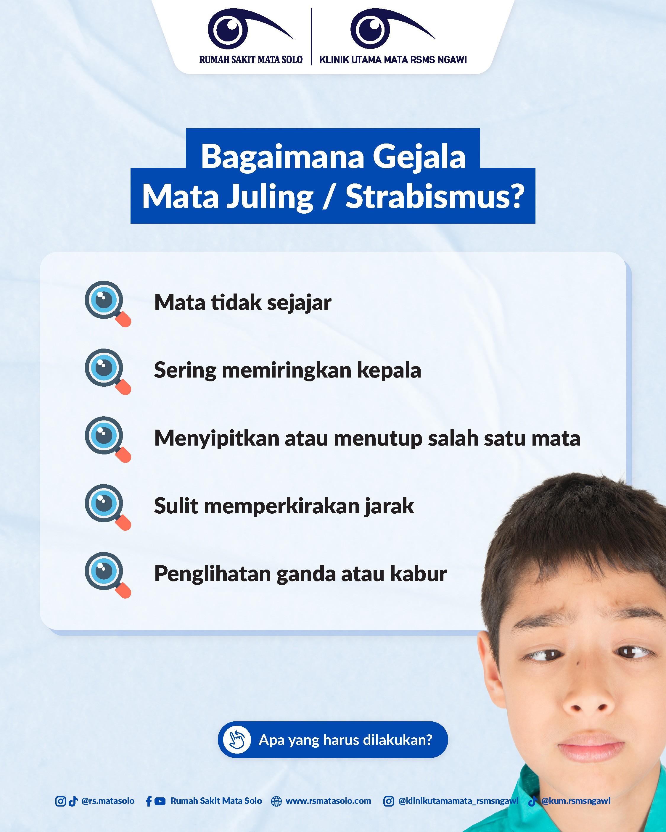 Mata Juling Strabismus RS Mata Solo