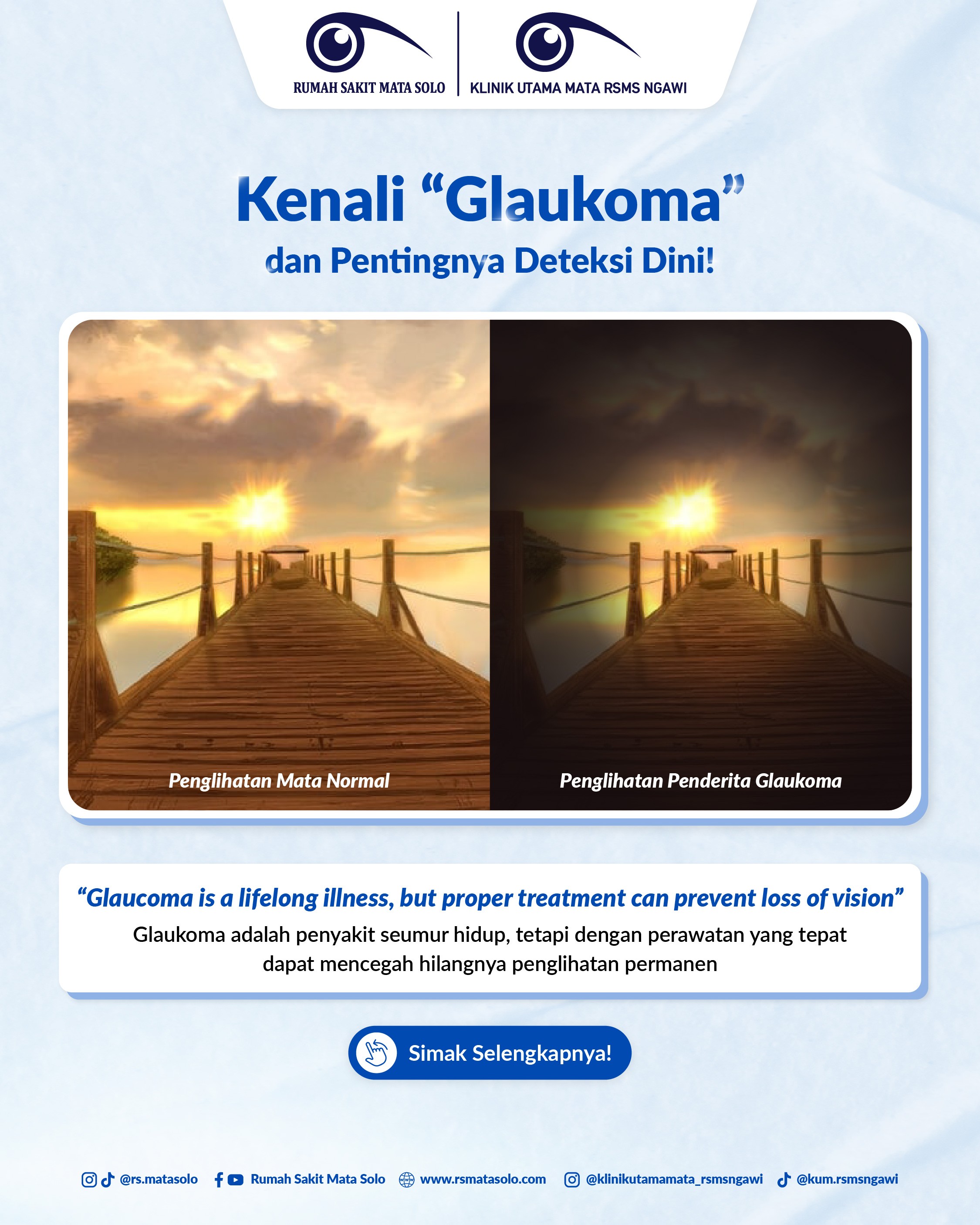 Glaukoma: Si Pencuri Penglihatan!